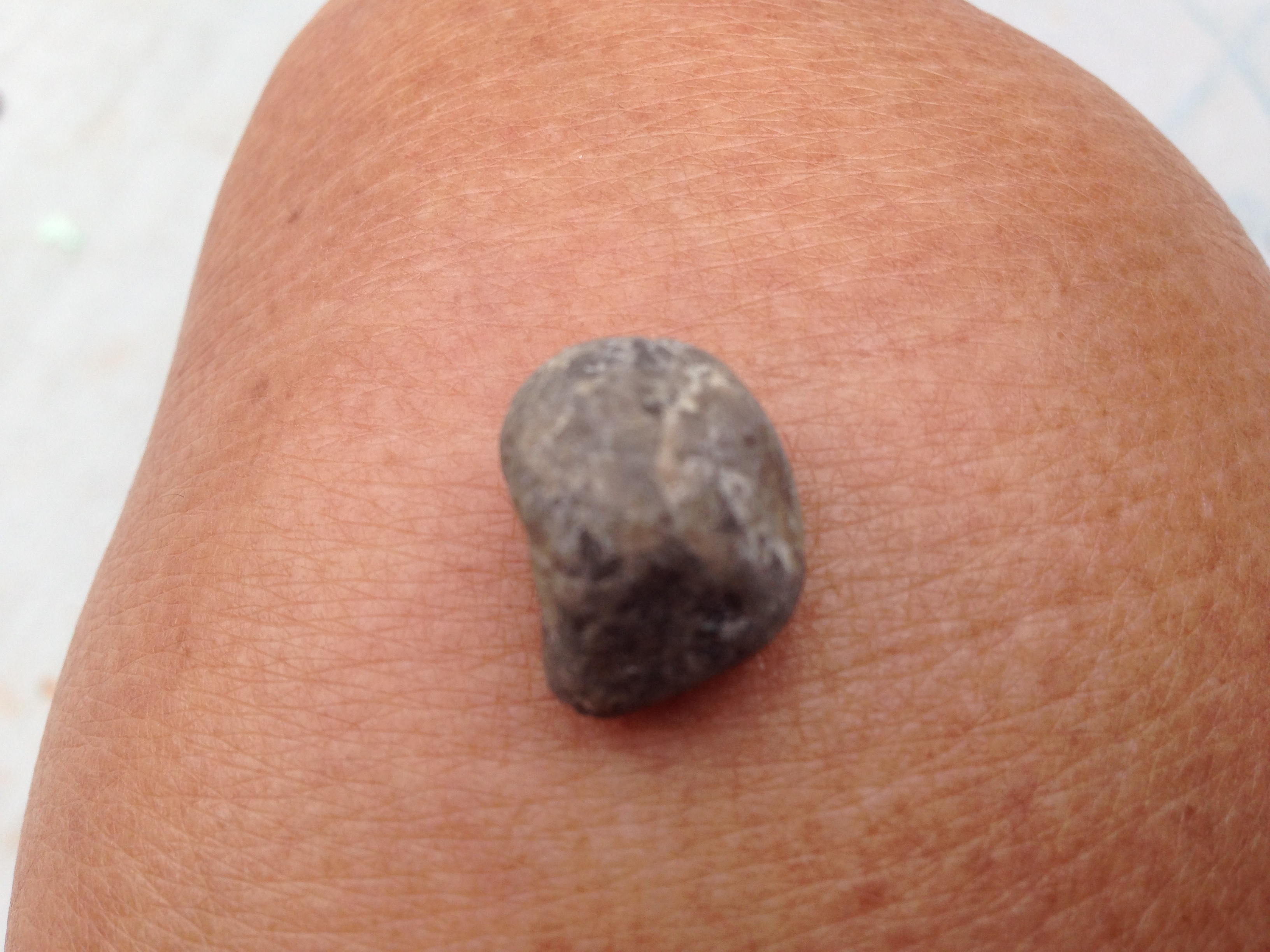 F31160D7-CE1D-4F66-BA65-1808CC617B3F